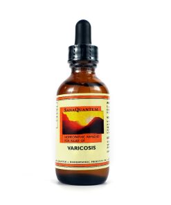 Varicosis